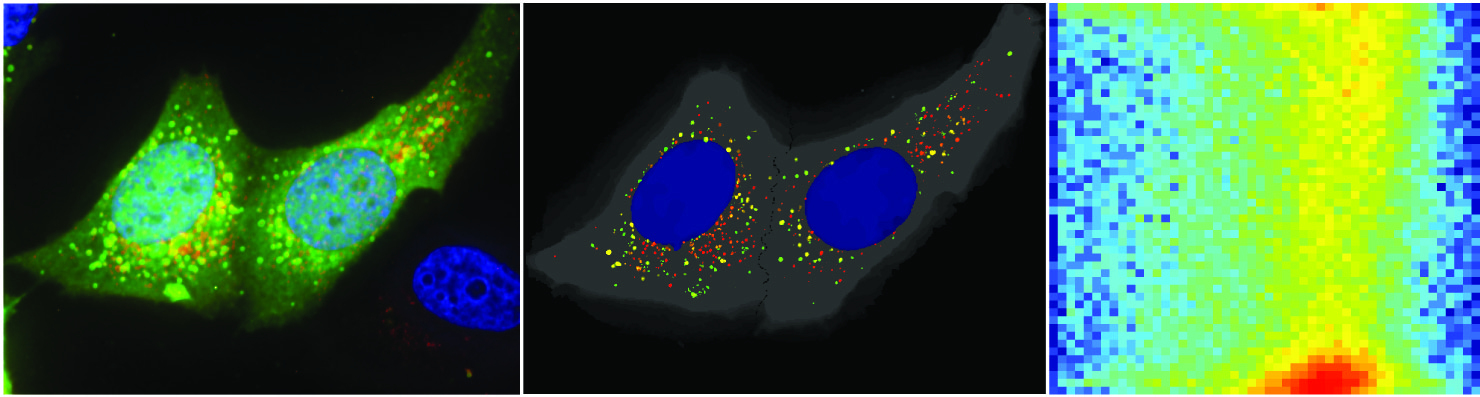 Figure Membrane Trafficking